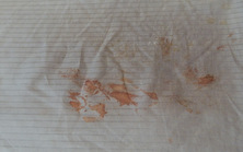 My new blue sheets. Hydrogen peroxide fixed most of the stains.